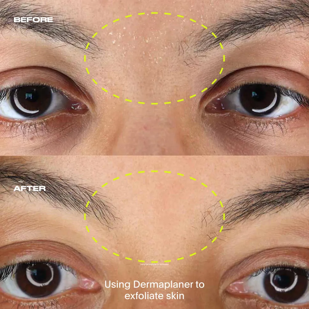 LEAF Dermaplaner ansiktsrakhyvel Prism verktyg