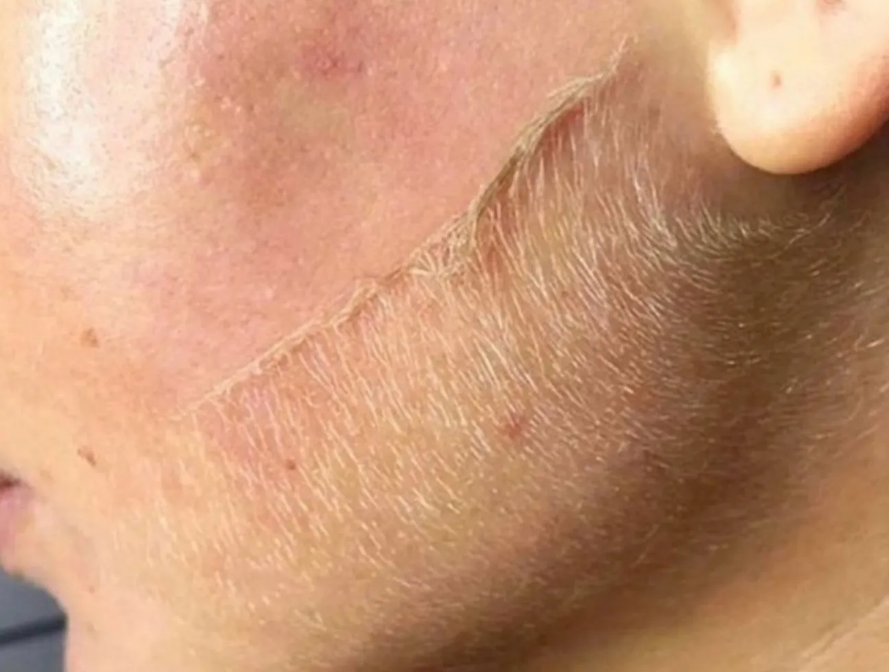 Melle Dermaplaner Razor 1.0 ansiktshyvel rosé